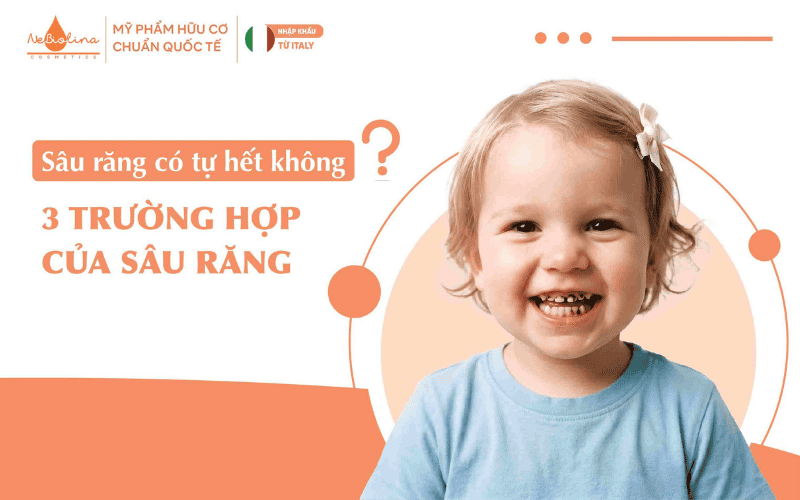 ảnh Sâu răng có tự hết không? 3 trường hợp của sâu răng (12)