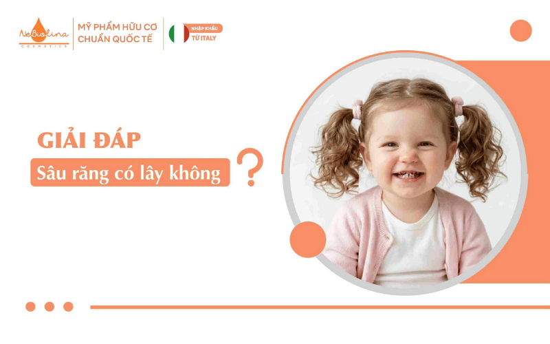 [Giải đáp] Sâu răng có lây không? 
