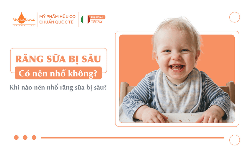 răng sữa bị sâu có nên nhổ