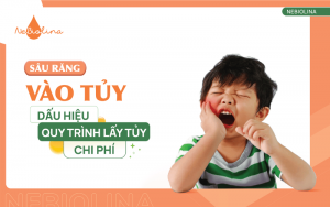 sâu răng vào tủy