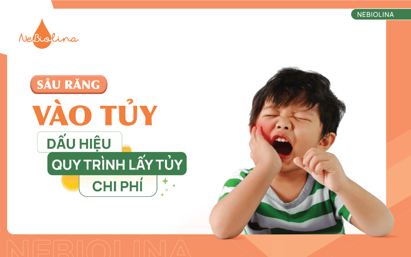 sâu răng vào tủy