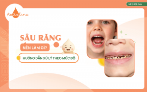 sâu răng nên làm gì