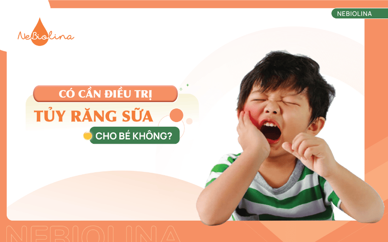 điều trị tuỷ răng sữa