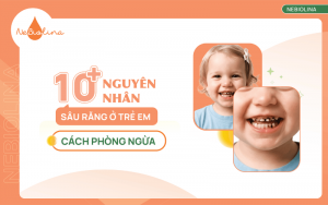 10+Nguyên nhân sâu răng ở trẻ em và cách phòng ngừa 