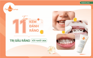 kem đánh răng trị sâu răng tốt nhất