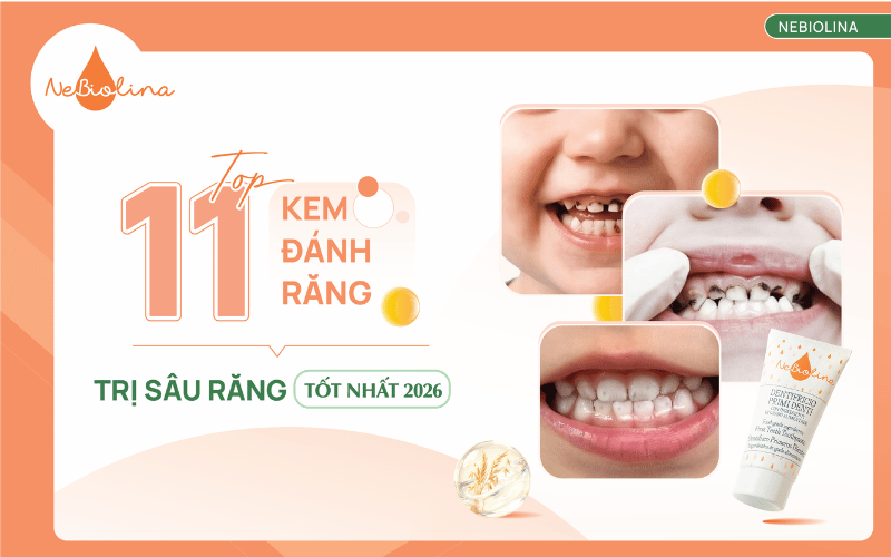 kem đánh răng trị sâu răng tốt nhất