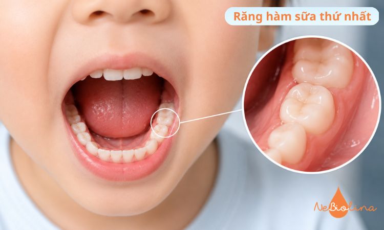 Răng hàm sữa thứ nhất - Chiếc răng bẹt đầu tiên