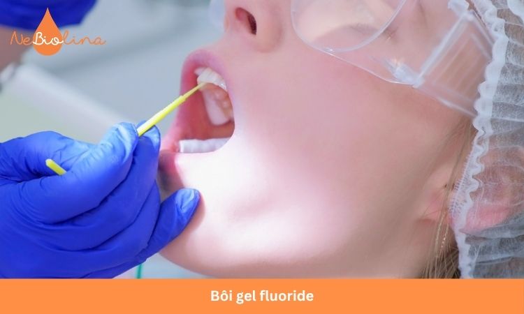 Bôi gel fluoride giúp ngăn ngừa sâu răng.