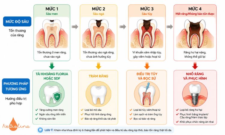 Phân loại mức độ sâu răng và hướng điều trị phù hợp 