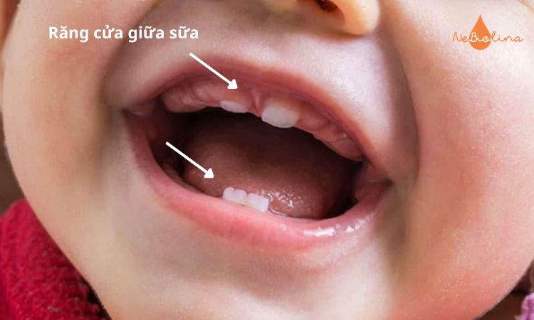 Răng cửa giữa sữa là những chiếc răng mọc sớm nhất, giúp bé cắt nhỏ thức ăn. 
