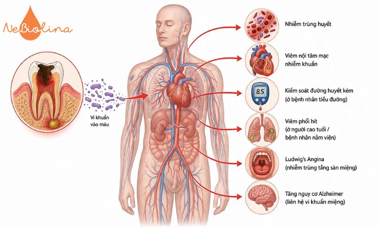 Sâu răng nặng ảnh hưởng đến nhiều cơ quan trong cơ thể. 