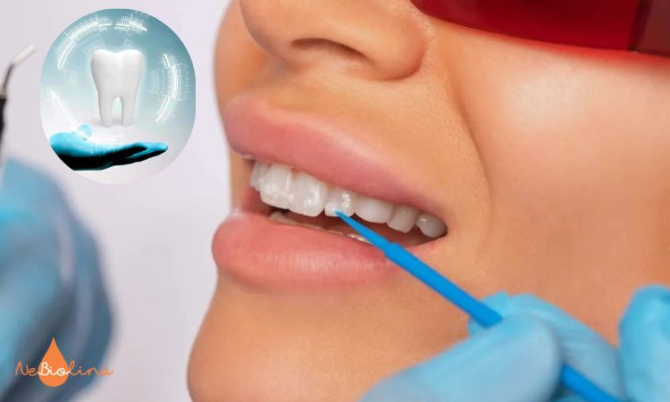 Tái khoáng Florua giúp ngăn sâu răng giai đoạn sớm 