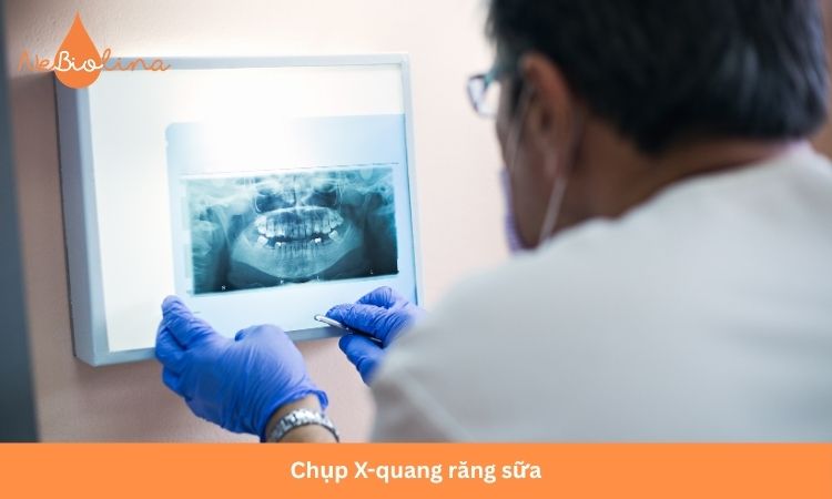 Đưa bé đi khám bác sĩ nếu có dấu hiệu mọc răng sữa bất thường.
