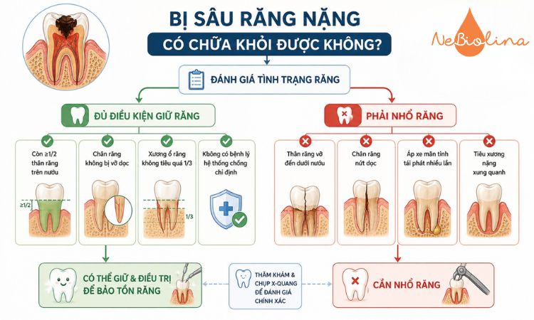 Sâu răng nặng có chữa được không tuỳ thuộc vào từng trường hợp.