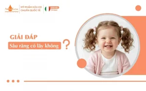 Sâu răng có lây không