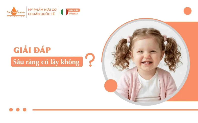 Sâu răng có lây không