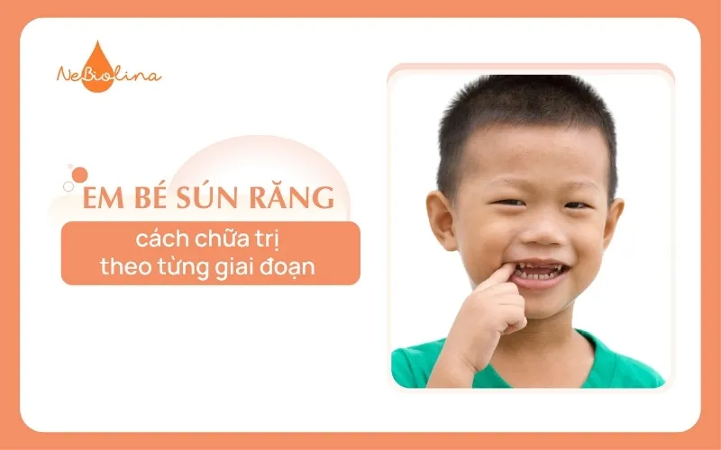 Em bé sún răng