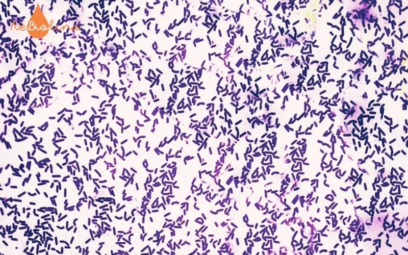 Hình ảnh vi khuẩn sâu răng Streptococcus dưới kính hiển vi