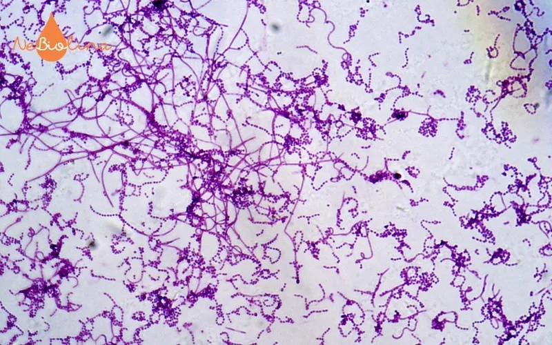 Hình ảnh vi khuẩn Lactobacillus dưới kính hiển vi