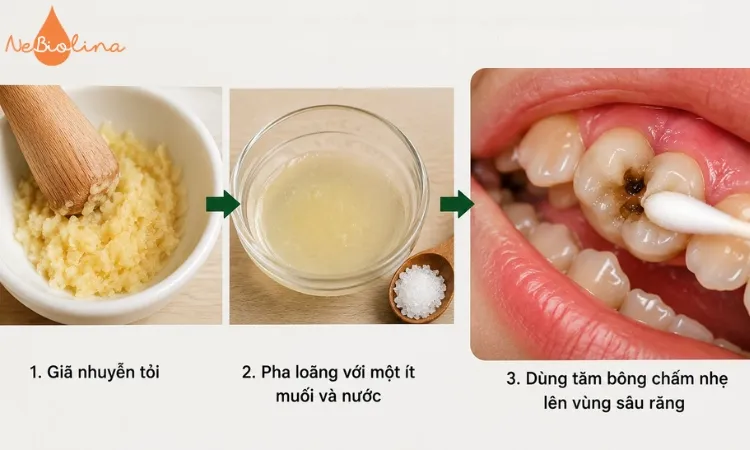 Cẩn thận khi dùng tỏi chữa sâu răng. 