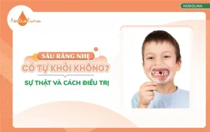 Sâu răng nhẹ