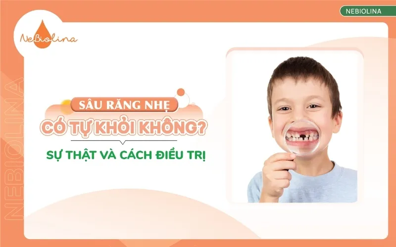 Sâu răng nhẹ