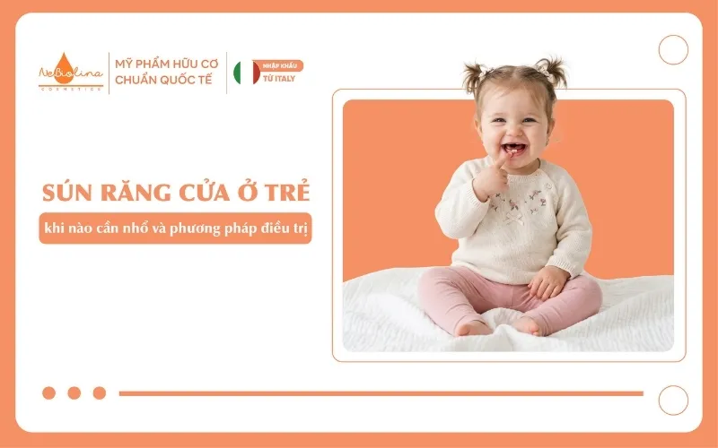 Sún răng cửa ở trẻ