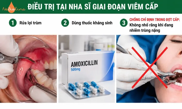 Đến nha sĩ để điều trị đúng cách khi bị viêm cấp tính.