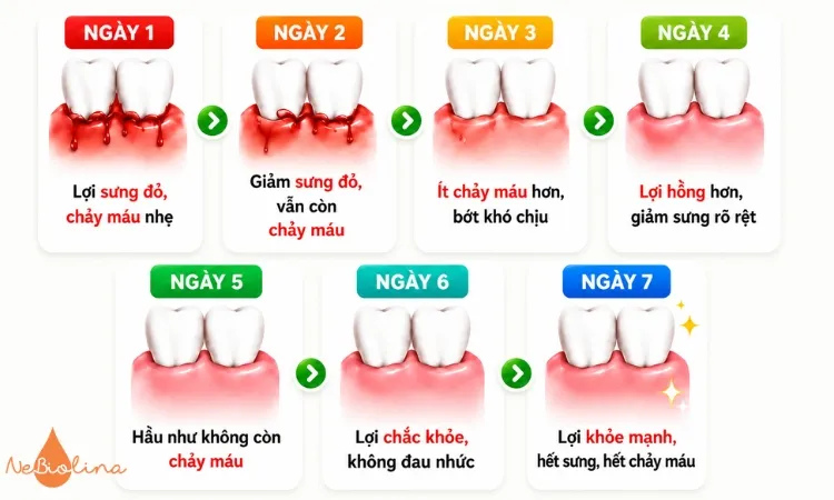 Viêm nướu thường cải thiện sau 3 - 7 ngày chăm sóc.