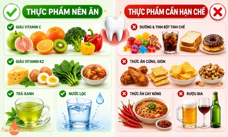 Lựa chọn thực phẩm phù hợp khi bị viêm nướu.