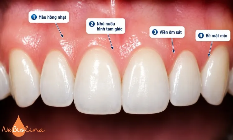 Hình ảnh nướu khỏe mạnh, không có dấu hiệu bất thường. 