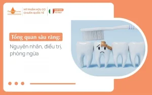 Sâu răng