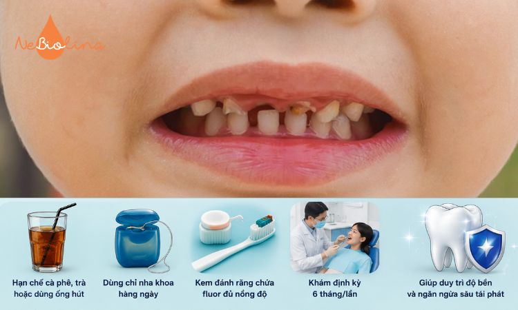 Chăm sóc răng sâu sau khi điều trị