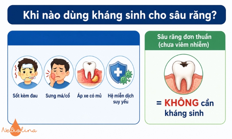 Không tự ý dùng thuốc kháng sinh khi bị sâu răng.