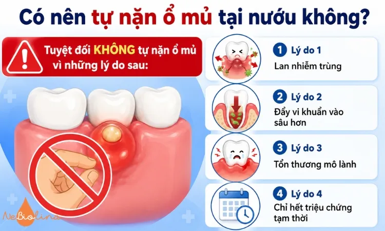 Tuyệt đối không tự nặn ổ mủ tại nướu.
