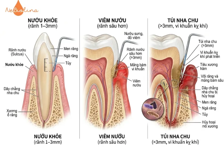 Sơ đồ giải phẫu nướu