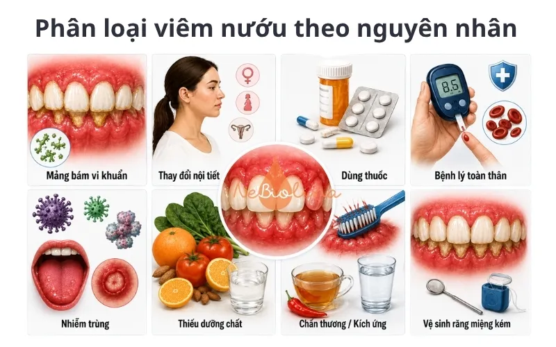 Thay đổi nội tiết, thiếu chất, nhiễm khuẩn có thể gây viêm nướu