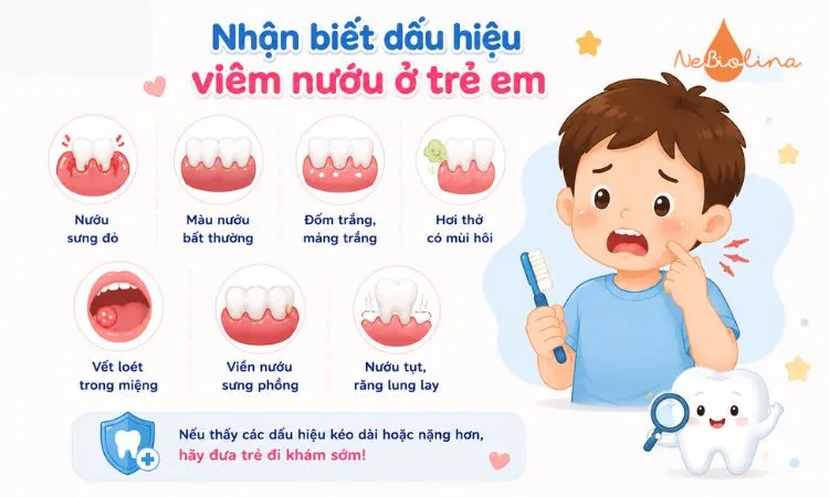 Các dấu hiệu thường gặp của viêm nướu ở trẻ em 