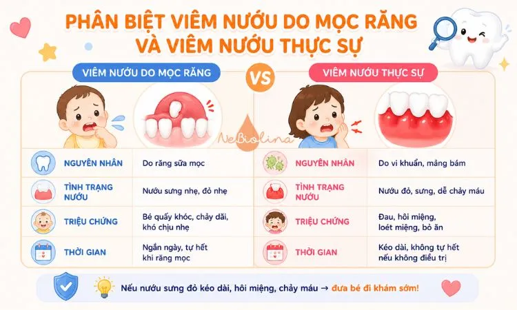 Phân biệt mọc răng sinh lý và viêm nướu thực sự
