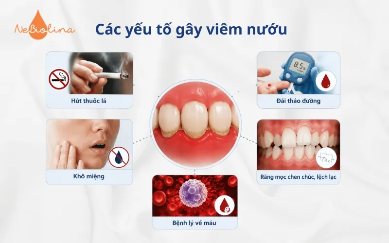 Các yếu tố khác gây viêm nướu 