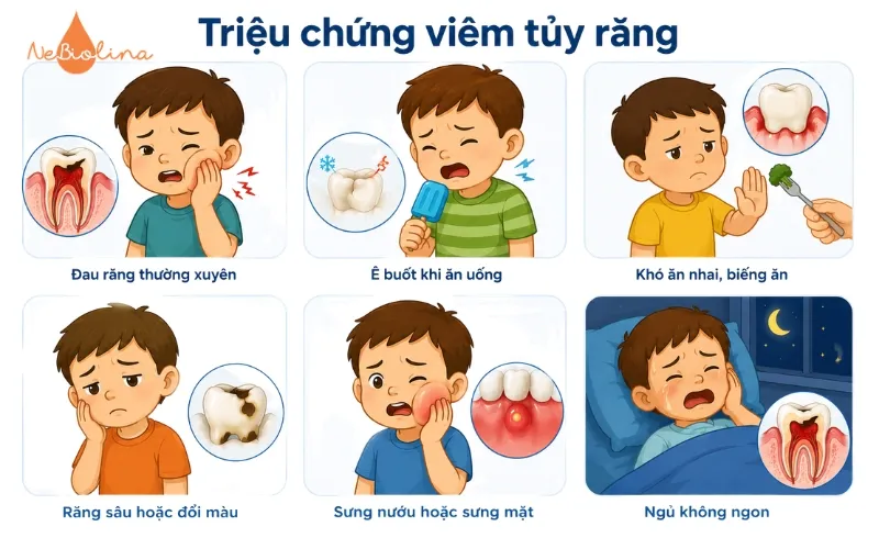 Triệu chứng viêm tủy răng ở trẻ