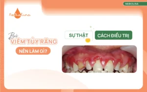 Bị viêm tủy răng nên làm gì Cách xử lý và điều trị