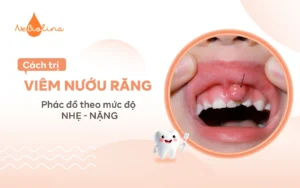 Cách trị viêm nướu răng