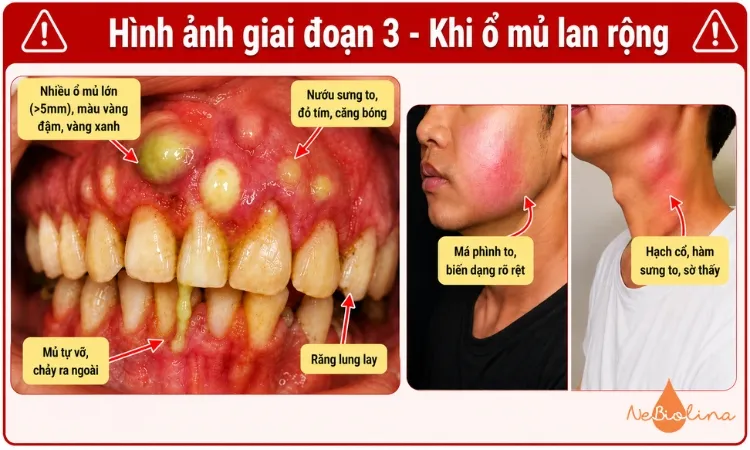 Cần đến phòng khám ngay lập tức khi thấy các dấu hiệu trên.