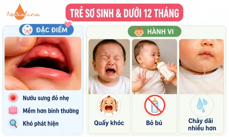 Viêm lợi ở trẻ sơ sinh thường khó phát hiện,