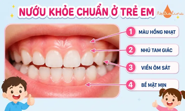 Hình ảnh nướu khoẻ chuẩn ở trẻ em.