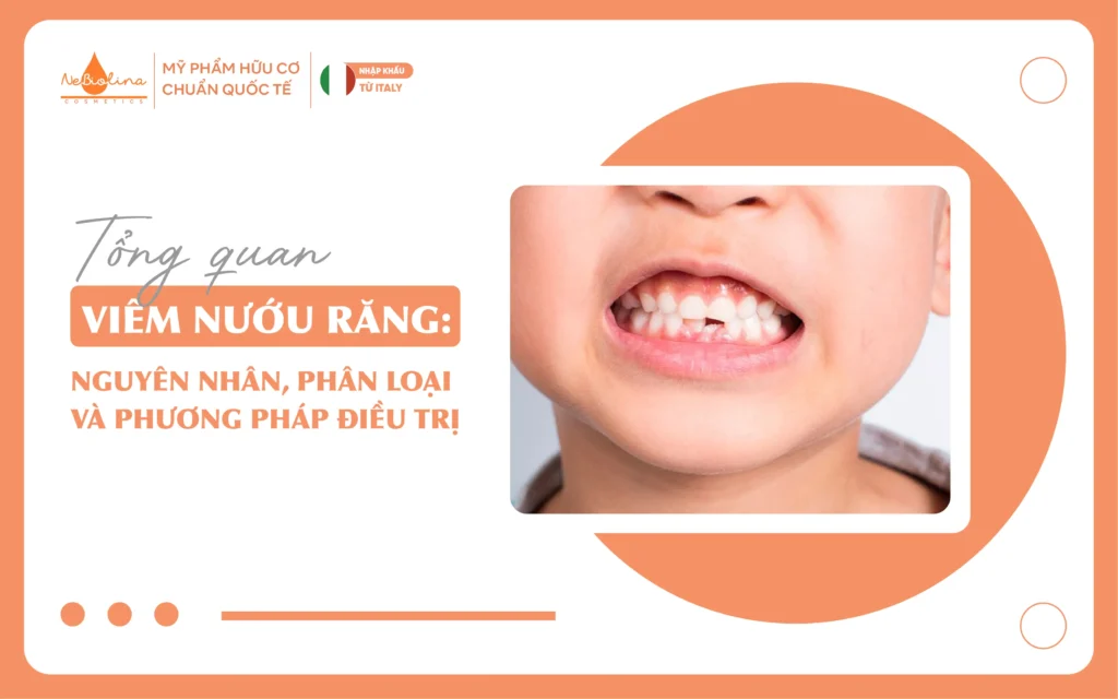 Tổng quan viêm nướu răng nguyên nhân, phân loại và phương pháp điều trị