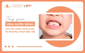 Tổng quan viêm nướu răng nguyên nhân, phân loại và phương pháp điều trị