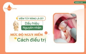 Viêm tủy răng là gì Nguyên nhân, dấu hiệu, mức độ nguy hiểm và cách điều trị