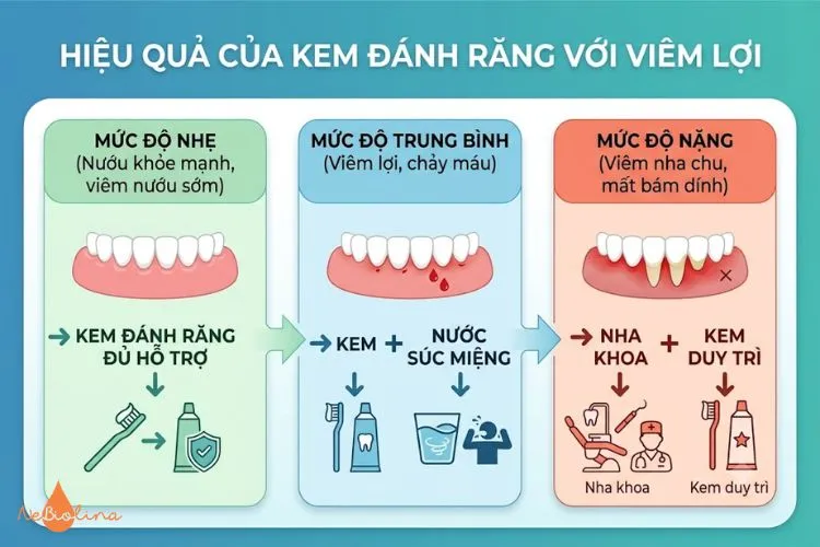 Hiệu quả của kem đánh răng với viêm lợi